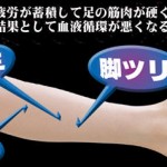 足のむくみはは早めに解消しないと病気になりやすい!?